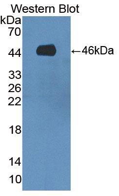 DAB staining on IHC-P; Samples: Human Liver Tissue; Primary Ab: 10µg/ml Rabbit Anti-Human SPAG1 Antibody Second Ab: 2µg/mL HRP-Linked Caprine Anti-Rabbit IgG Polyclonal Antibody