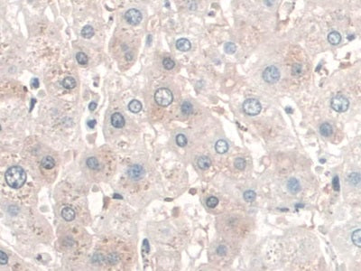 DAB staining on fromalin fixed paraffin- embedded Kidney tissue)