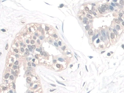 Sperm Associated Antigen 1 (SPAG1) Polyclonal Antibody - image 5