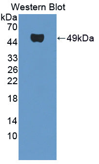 Western Blot; Sample: Lane1: Porcine Stomach lysate; Lane2: Porcine Small intestine lysate; Lane3: Porcine Colon lysate; Primary Ab: 2μg/ml Rabbit Anti-Human SMTN Antibody; Second Ab: 0.2µg/mL HRP-Linked Caprine Anti-Rabbit IgG Polyclonal Antibody;