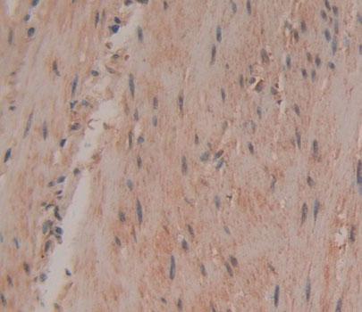 Smoothelin (SMTN) Polyclonal Antibody - image 4