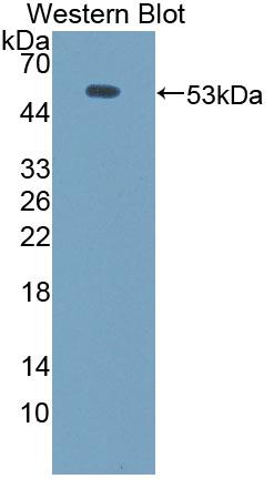 Aminoadipate Semialdehyde Synthase (AASS) Polyclonal Antibody - image 2