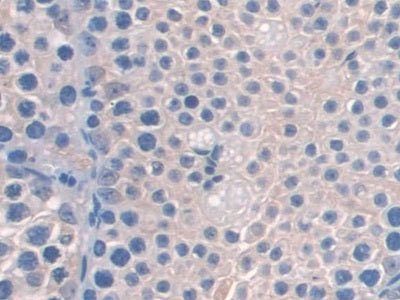DAB staining on fromalin fixed paraffin- embedded Kidney tissue)