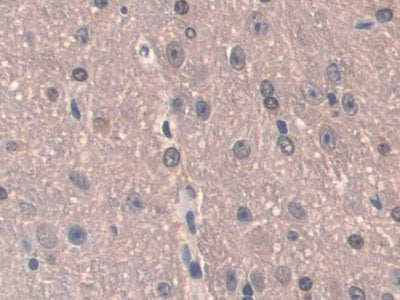 Aminoadipate Semialdehyde Synthase (AASS) Polyclonal Antibody - image 4
