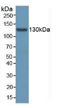 Western Blot; Sample: Recombinant AASS, Human.