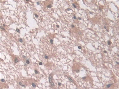 DAB staining on IHC-P; Samples: Human Stomach Tissue.