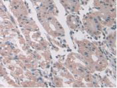 Aminoadipate Semialdehyde Synthase (AASS) Polyclonal Antibody - image 5