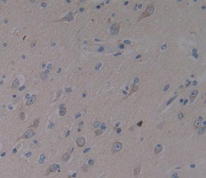 Spermine Synthase (SMS) Polyclonal Antibody - image 4