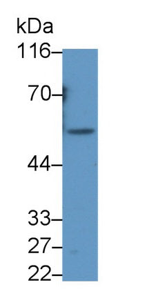 Src Kinase Associated Phosphoprotein 1 (SKAP1) Polyclonal Antibody - image 2
