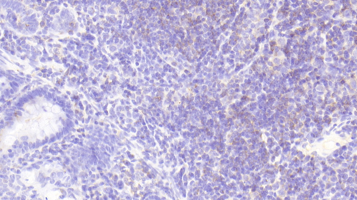 DAB staining on fromalin fixed paraffin- embedded spleen tissue)