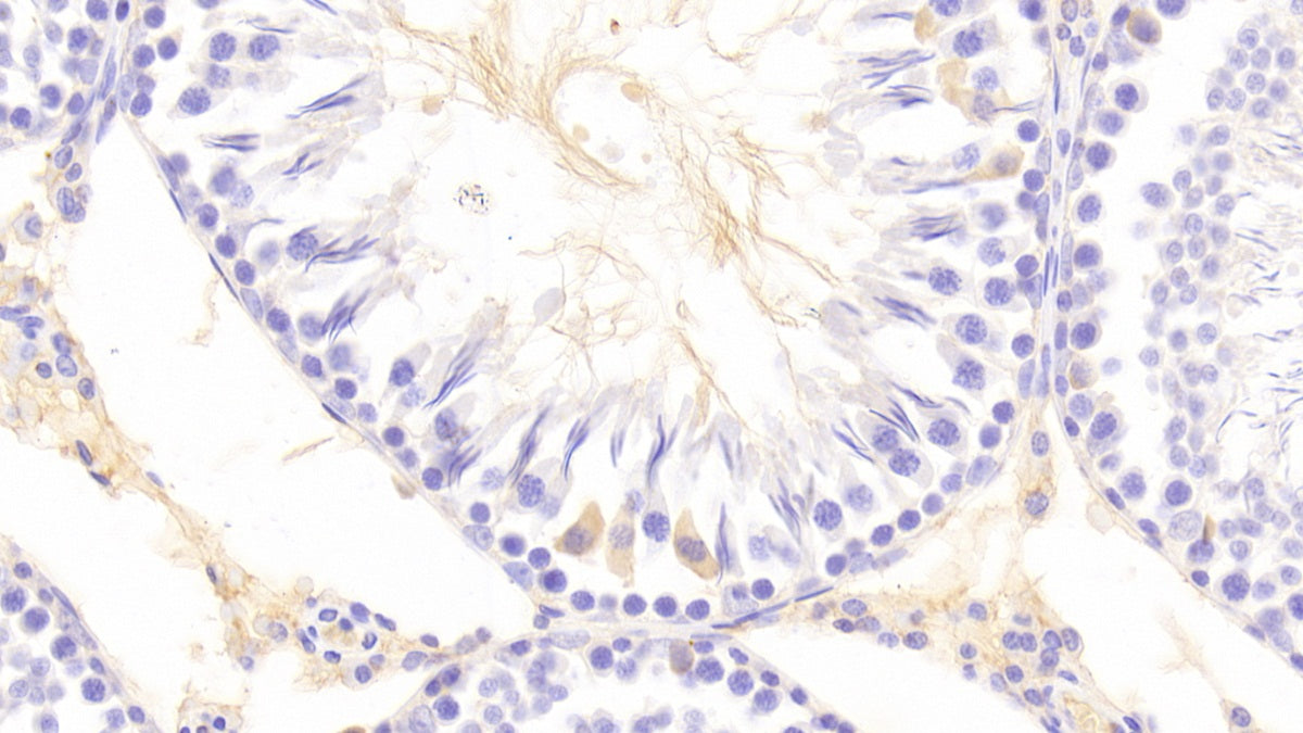 Src Kinase Associated Phosphoprotein 1 (SKAP1) Polyclonal Antibody - image 4