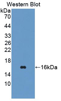 Sterol Carrier Protein 2 (SCP2) Polyclonal Antibody - image 2