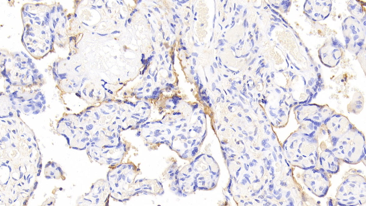 DAB staining on fromalin fixed paraffin- embedded liver tissue)
