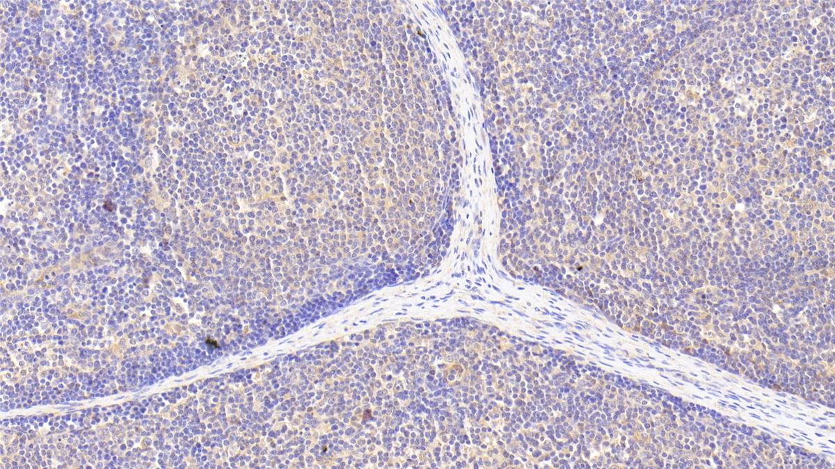 Sterol Carrier Protein 2 (SCP2) Polyclonal Antibody - image 4