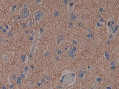 DAB staining on IHC-P; Samples: Human Brain Tissue.