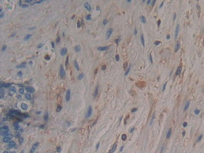 Adenylyl Cyclase Associated Protein 2 (CAP2) Polyclonal Antibody - image 5