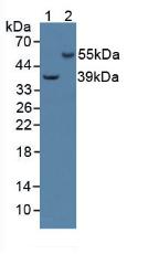 Western Blot; Sample: Recombinant CAP2, Human.