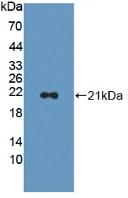 DAB staining on IHC-P; Samples: Human Liver Tissue; Primary Ab: 30µg/ml Rabbit Anti-Human CAP2 Antibody Second Ab: 2µg/mL HRP-Linked Caprine Anti-Rabbit IgG Polyclonal Antibody