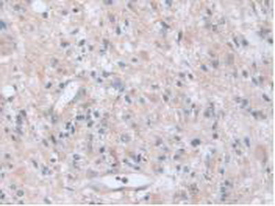 Adenylyl Cyclase Associated Protein 2 (CAP2) Polyclonal Antibody - image 5