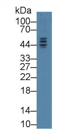 Western Blot; Sample: Human Hela cell lysate; Primary Ab: 1µg/ml Rabbit Anti-Human TMPO Antibody Second Ab: 0.2µg/mL HRP-Linked Caprine Anti-Rabbit IgG Polyclonal Antibody