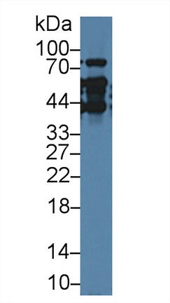 FITC staining on IF; Samples: Human Hela Cells; Primary Ab: 20µg/ml Rabbit Anti-Human TMPO Antibody Second Ab: 1µg/ml FITC-Linked Caprine Anti-Rabbit IgG Polyclonal Antibody