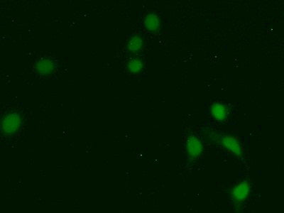 FITC staining on IHC-P Simple: Hela cells)