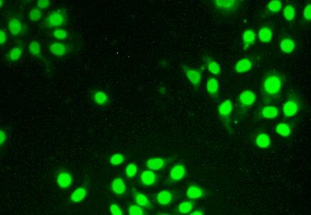 Thymopoietin (TMPO) Polyclonal Antibody - image 5