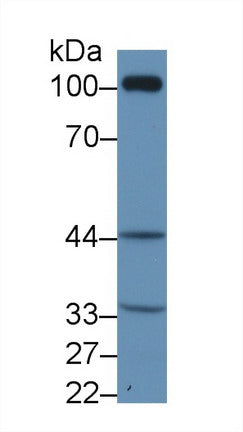 Western Blot; Sample: Recombinant protein.
