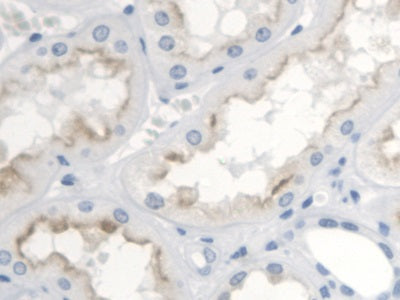 Thromboxane Receptor (TP) Polyclonal Antibody - image 5