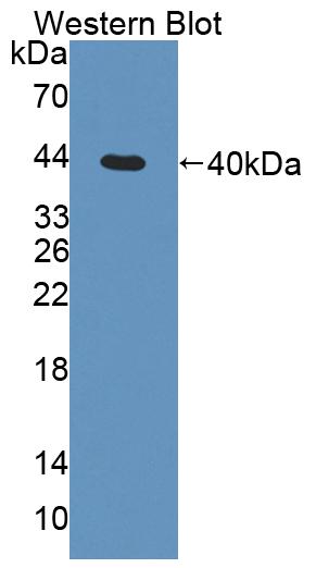 Western Blot; Sample: Lane1: Rat Skeletal muscle lysate; Lane2: Human Hela cell lysate; Lane3: Human 293T cell lysate; Primary Ab: 1µg/mL Rabbit Anti-Human TSTA3 Antibody; Second Ab: 0.2µg/mL HRP-Linked Caprine Anti-Rabbit IgG Polyclonal Antibody;