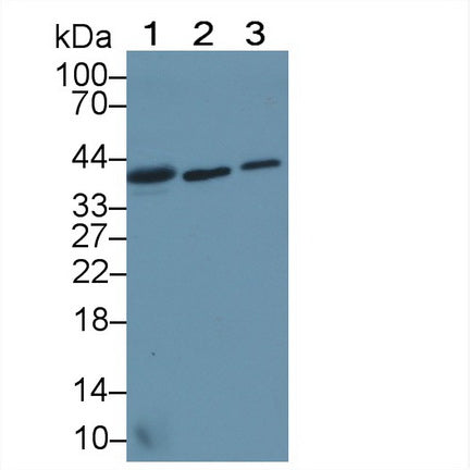 DAB staining on IHC-P; Samples: Human Kidney Tissue;  Primary Ab: 20μg/ml Rabbit Anti-Human TSTA3 Antibody Second Ab: 2µg/mL HRP-Linked Caprine Anti-Rabbit IgG Polyclonal Antibody