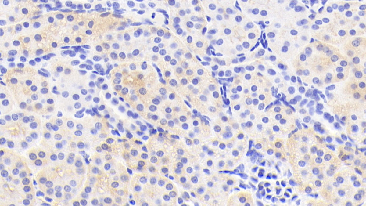Tissue Specific Transplantation Antigen P35B (TSTA3) Polyclonal Antibody - image 4