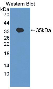 Trinucleotide Repeat Containing Protein 6A (TNRC6A) Polyclonal Antibody - image 2