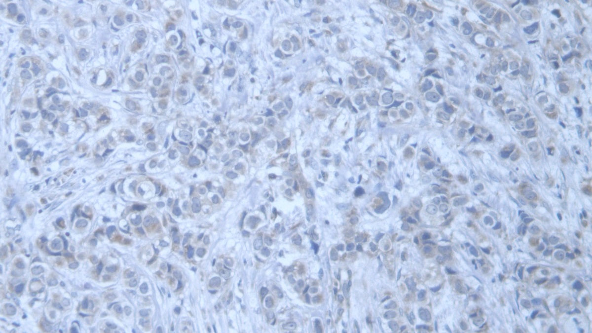 Trinucleotide Repeat Containing Protein 6A (TNRC6A) Polyclonal Antibody - image 3