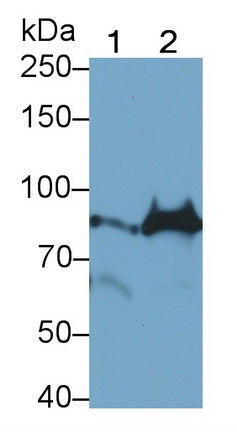 DAB staining on IHC-P; Samples: Human Glioma Tissue;  Primary Ab: 30µg/ml Rabbit Anti-Human TNFaIP3