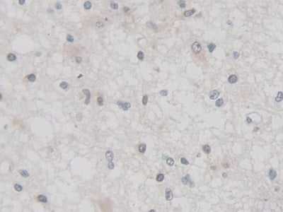 Tumor Necrosis Factor Alpha Induced Protein 3 (TNFaIP3) Polyclonal Antibody - image 4