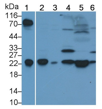 Thymocyte Nuclear Protein 1 (THYN1) Polyclonal Antibody - image 2