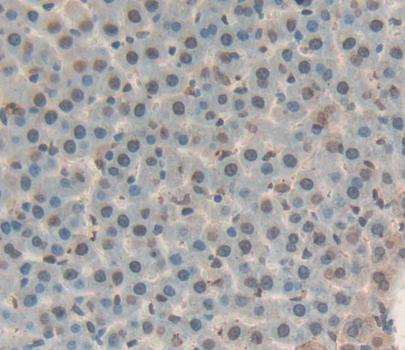 Thymocyte Nuclear Protein 1 (THYN1) Polyclonal Antibody - image 3