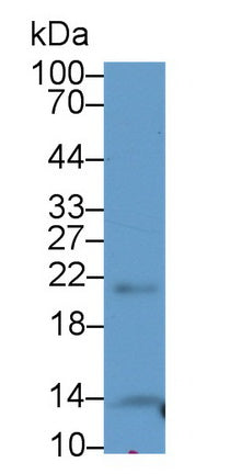DAB staining on IHC-P; Samples: Human Liver Tissue;  Primary Ab: 20μg/ml Rabbit Anti-Human THRSP Antibody Second Ab: 2µg/mL HRP-Linked Caprine Anti-Rabbit IgG Polyclonal Antibody
