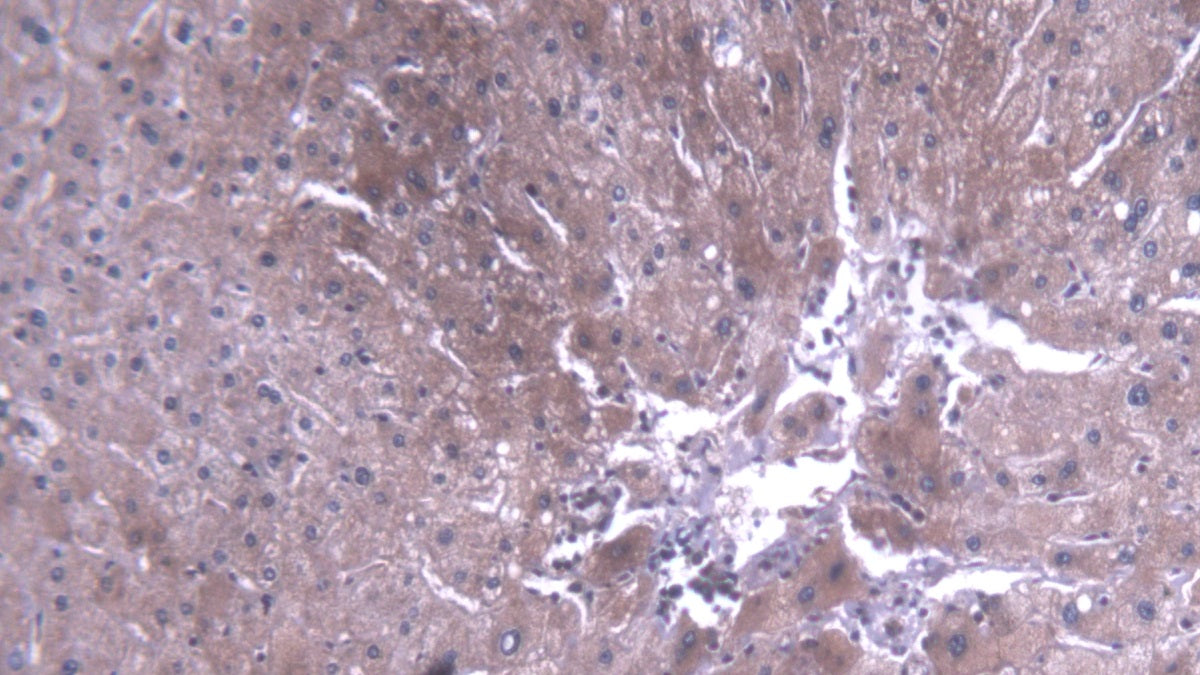 Tec Protein Tyrosine Kinase (TEC) Polyclonal Antibody - image 4