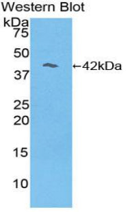 DAB staining on IHC-P; Samples: Mouse Liver Tissue; Primary Ab: 20μg/ml Rabbit Anti-Mouse RL Antibody Second Ab: 2µg/mL HRP-Linked Caprine Anti-Rabbit IgG Polyclonal Antibody