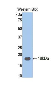 DAB staining on IHC-P; Samples: Human Liver Tissue; Primary Ab: 30µg/ml Rabbit Anti-Human RPN1 Antibody Second Ab: 2µg/mL HRP-Linked Caprine Anti-Rabbit IgG Polyclonal Antibody