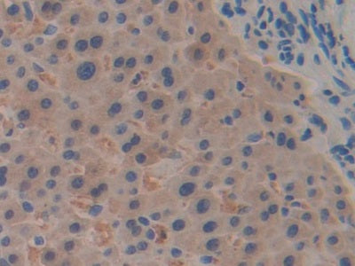 Ribophorin I (RPN1) Polyclonal Antibody - image 5