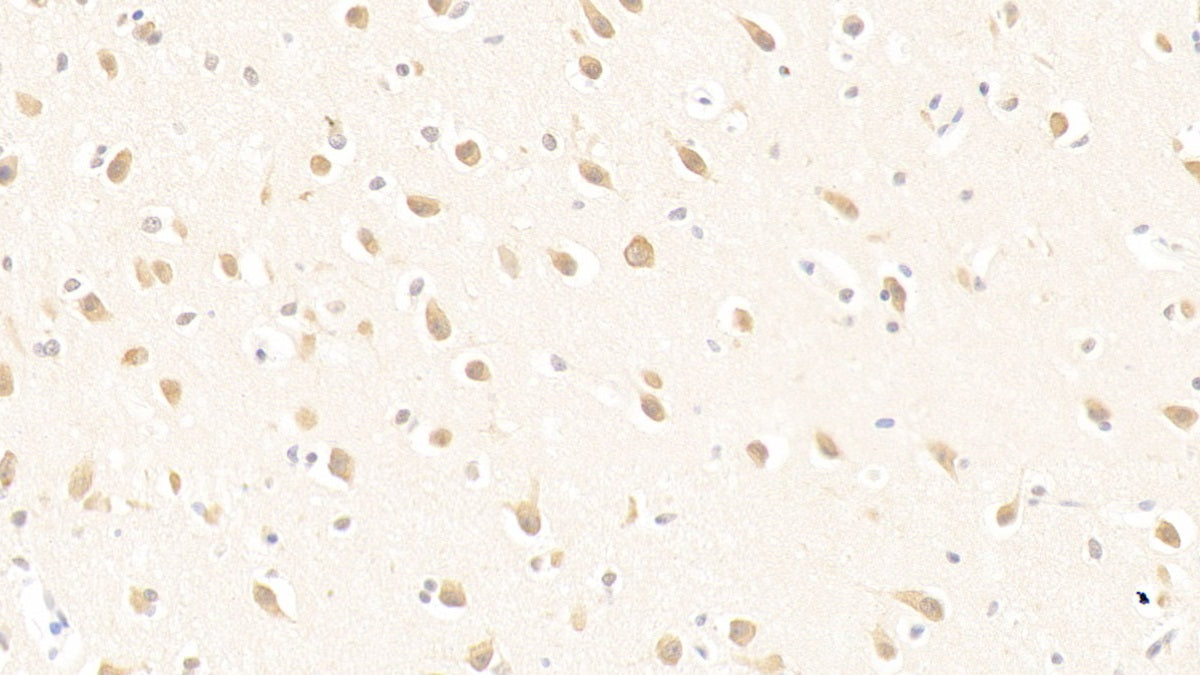 DAB staining on IHC-P; Samples: Human Kidney Tissue; Primary Ab: 20μg/ml Rabbit Anti-Human PURA Antibody Second Ab: 2µg/mL HRP-Linked Caprine Anti-Rabbit IgG Polyclonal Antibody
