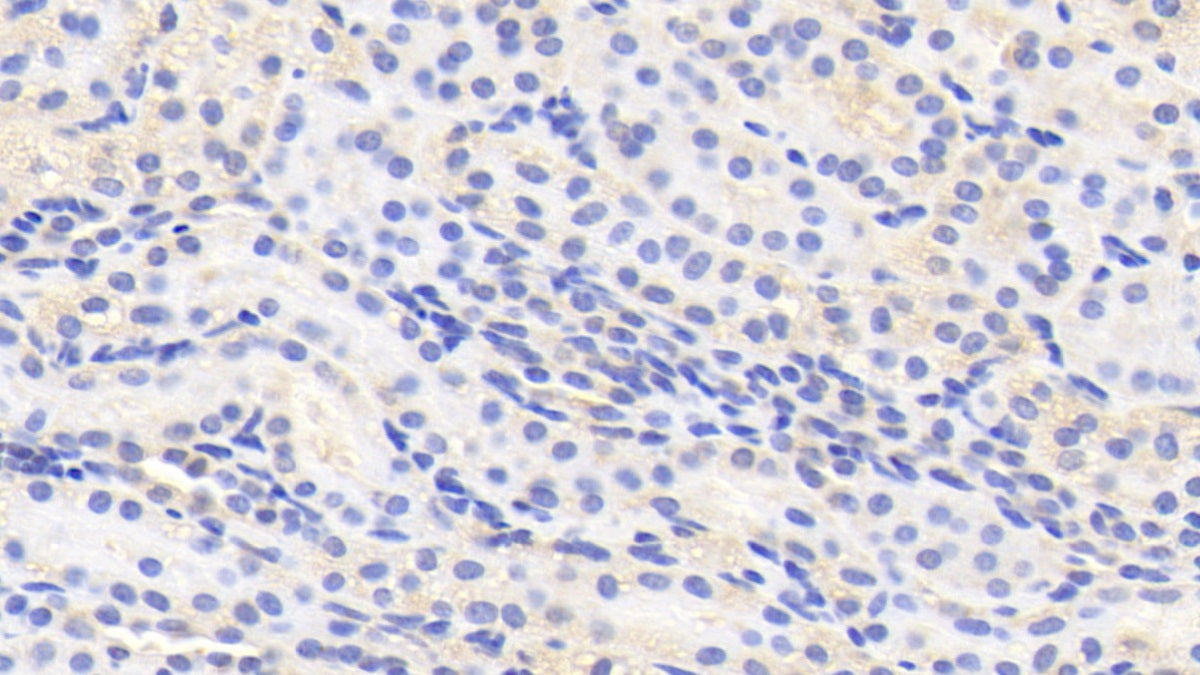 Purine Rich Element Binding Protein A (PURA) Polyclonal Antibody - image 5