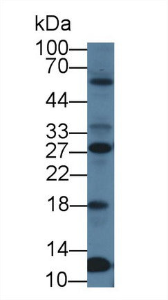 Western Blot; Sample: Recombinant protein.