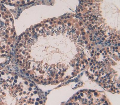 Pituitary Tumor Transforming 1 (PTTG1) Polyclonal Antibody - image 4