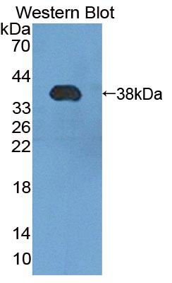 Phosphomannomutase 1 (PMM1) Polyclonal Antibody - image 2