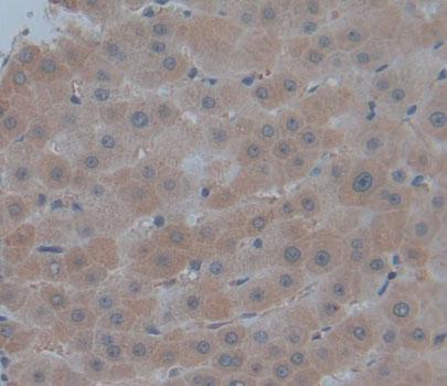 Phosphomannomutase 1 (PMM1) Polyclonal Antibody - image 3