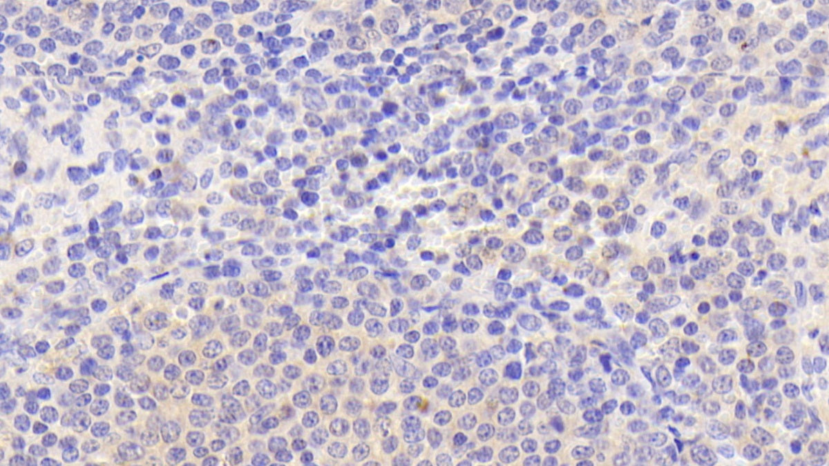 Peptidyl Arginine Deiminase Type I (PADI1) Polyclonal Antibody - image 4